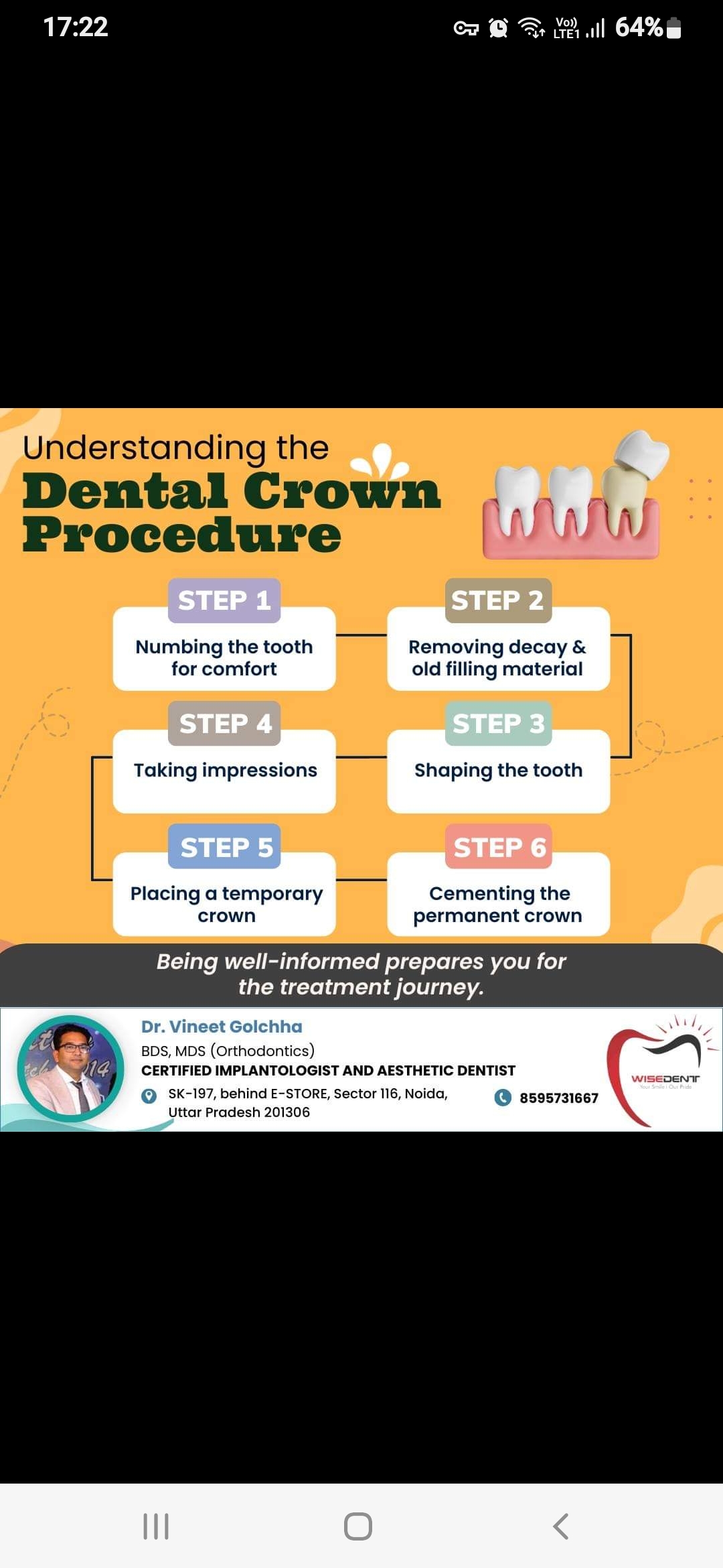 Dental crown 