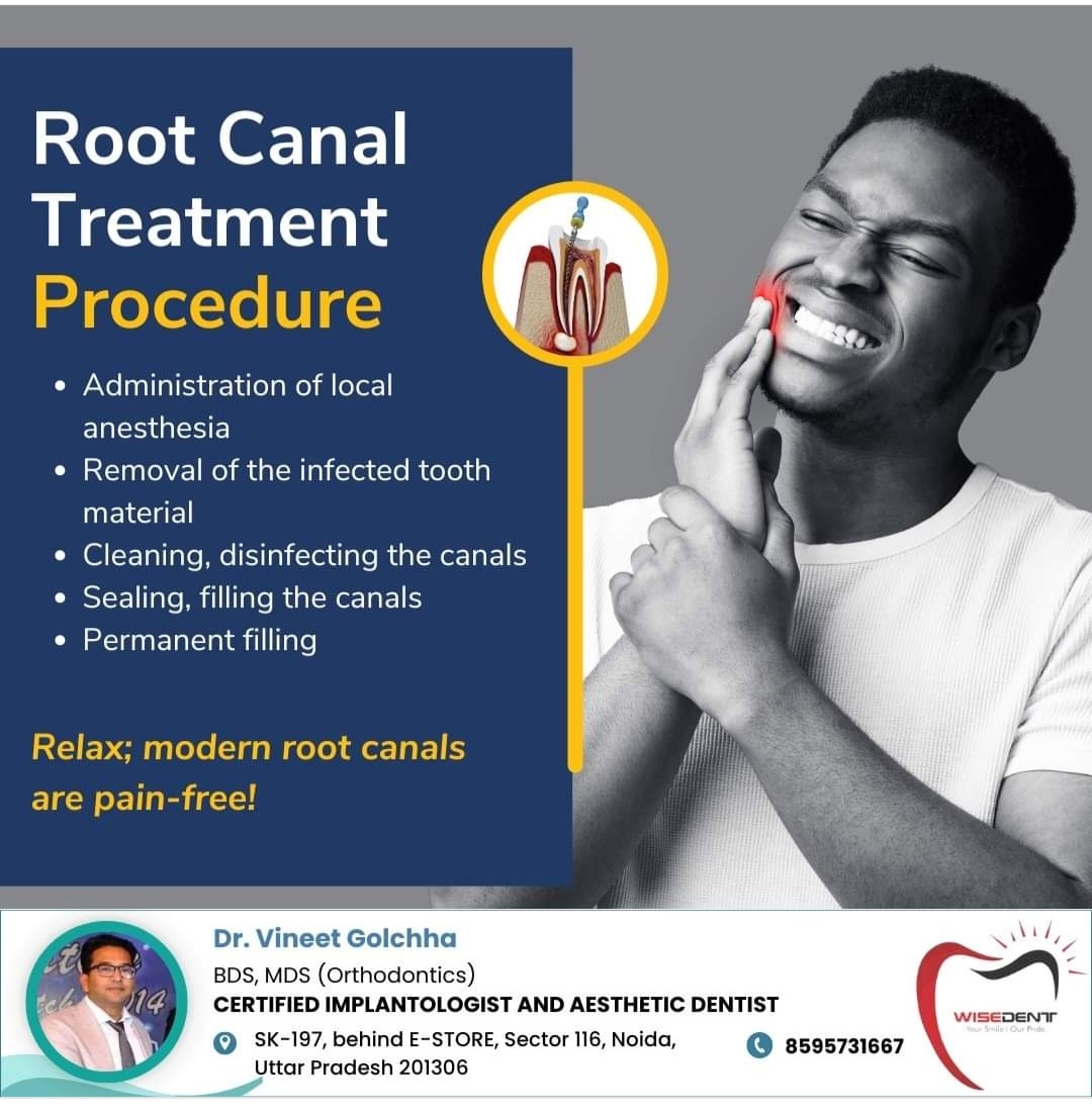 Root Canal Treatment 