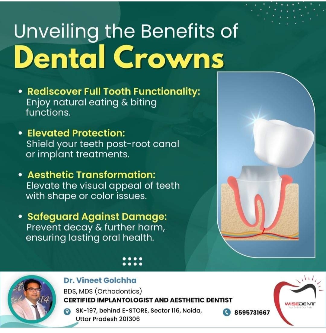 Dental crown 