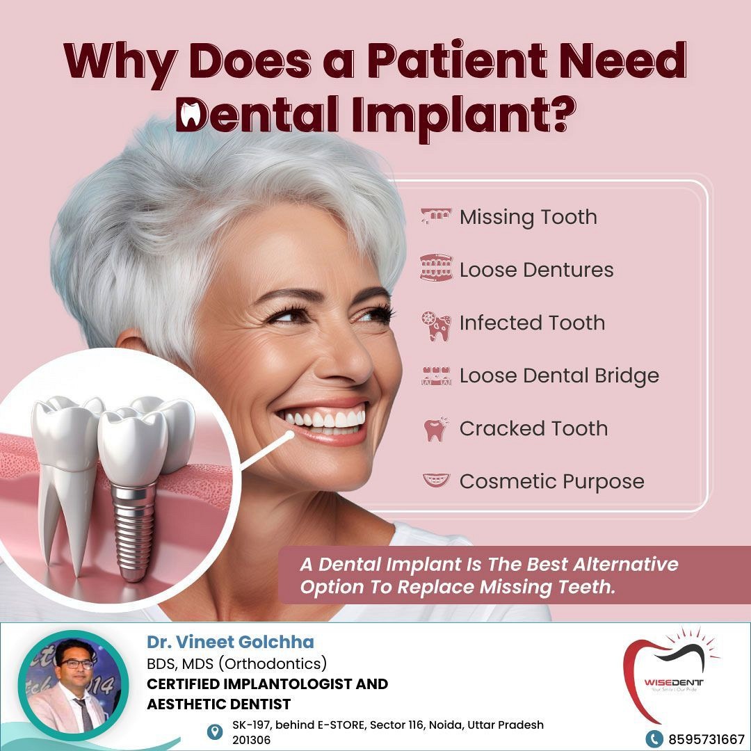 Why Does a Patient Need Dental Implant