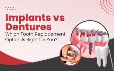 Implants vs Dentures: Which Tooth Replacement Option Is Right for You?