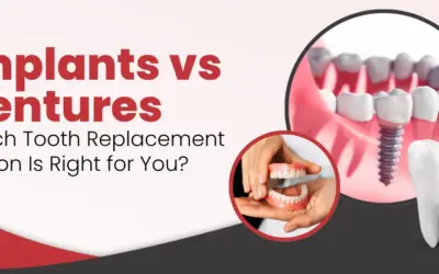 Implants vs Dentures: Which Tooth Replacement Option Is Right for You?