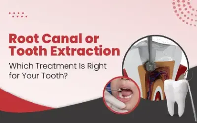 Root Canal or Tooth Extraction: Which Treatment Is Right for Your Tooth?