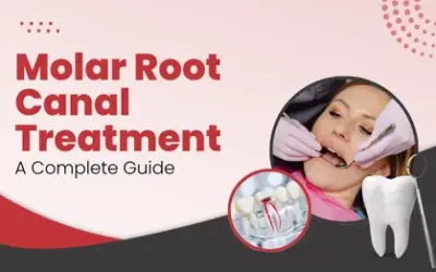 Molar Root Canal Procedure: Step-by-Step Guide