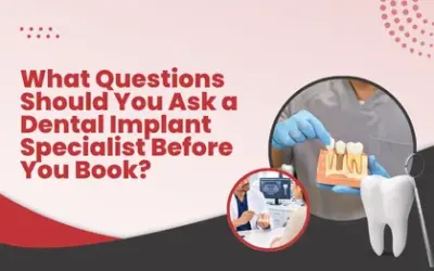 What Questions Should You Ask a Dental Implant Specialist Before You Book?